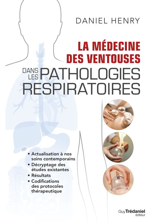 La médecine des ventouses dans les pathologies respiratoires